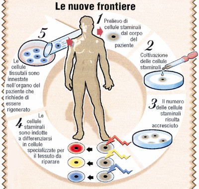 cellule staminali